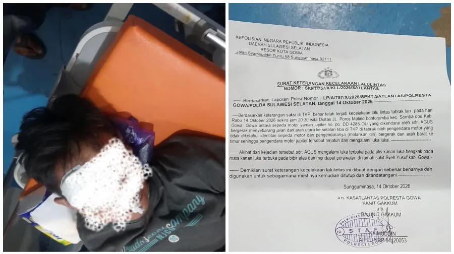 Korban tabrak lari (Dok: Ist)