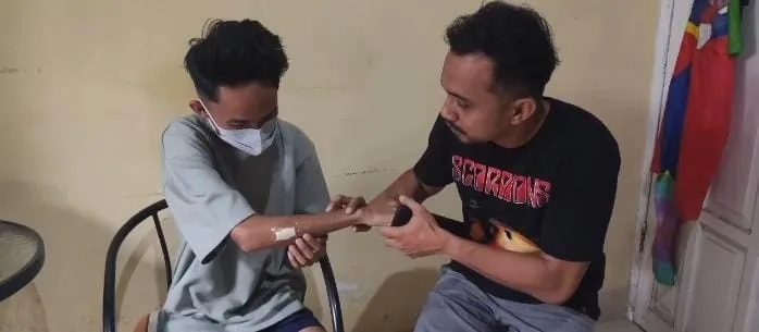 Korban pembusuran oleh sekelompok orang yang diduga anggota geng motor di Kabupaten Gowa (Dok: Ist