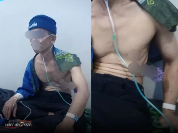 Kondisi korban pembusuran di Takalar (Dok: Ist).