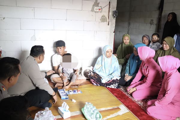 Merasa Iba, Kapolres Jeneponto Tanggung Seluruh Biaya Pengobatan Balita Penderita Tumor Mata